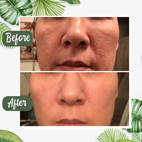 NEGUSY™ Green Tea Deep Cleanse Mask Stick