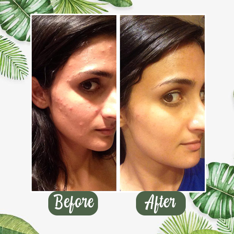 NEGUSY™ Green Tea Deep Cleanse Mask Stick