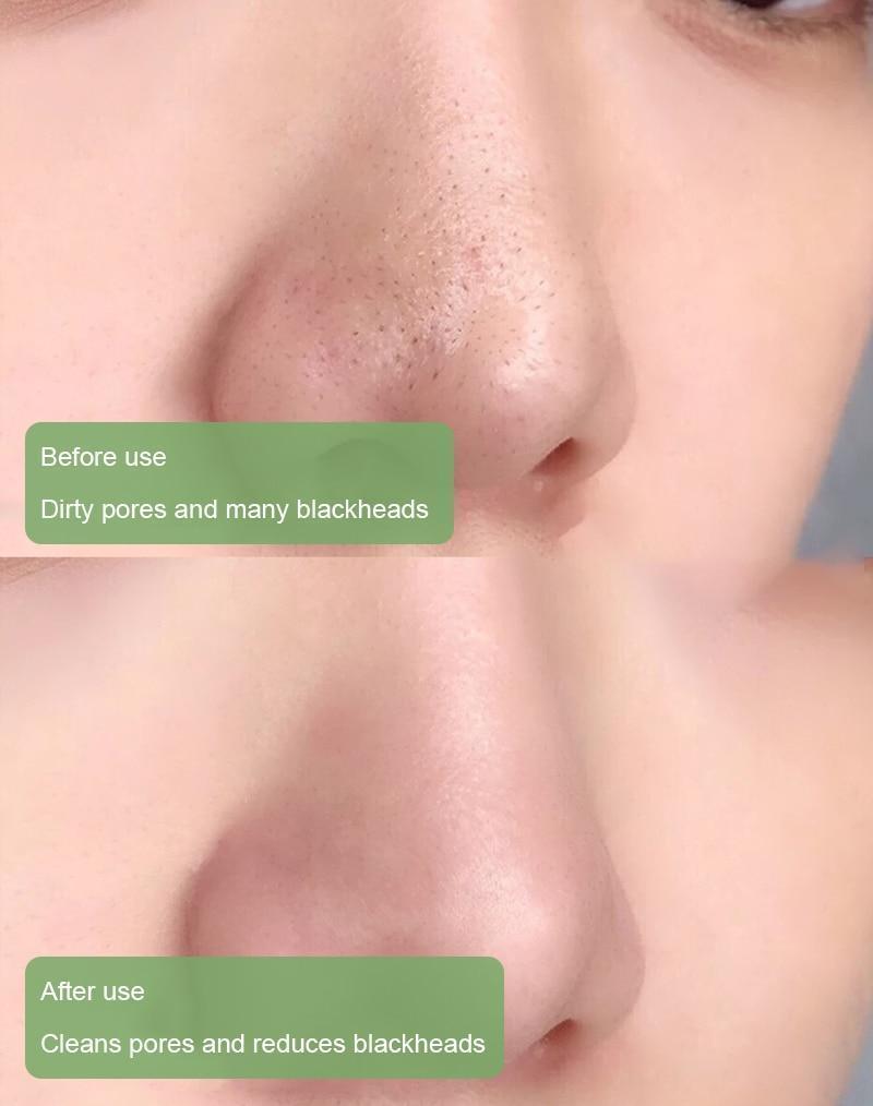 NEGUSY™ Green Tea Deep Cleanse Mask Stick