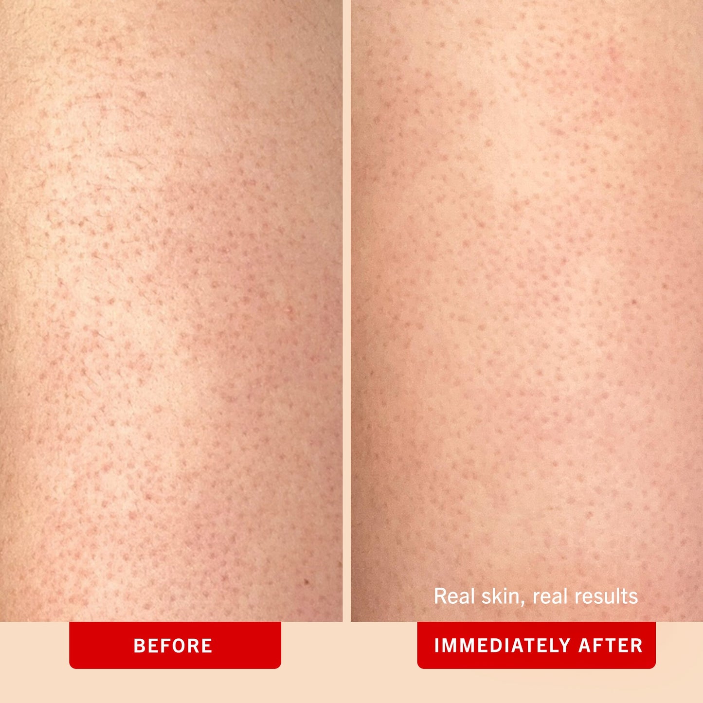 🧼 Exfoliate, Brighten & Hydrate All-in-One