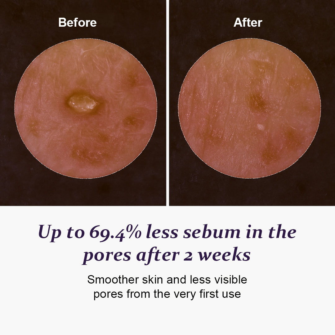Gentle Exfoliation for a Silky Smooth Texture 🌟