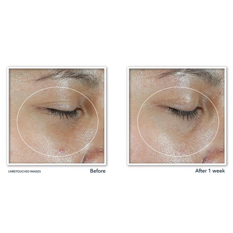 Revive + Glow Eye Balm with Vitamin C brightens and reduces puffiness ✨Buy 3 Free Shipping Only Today