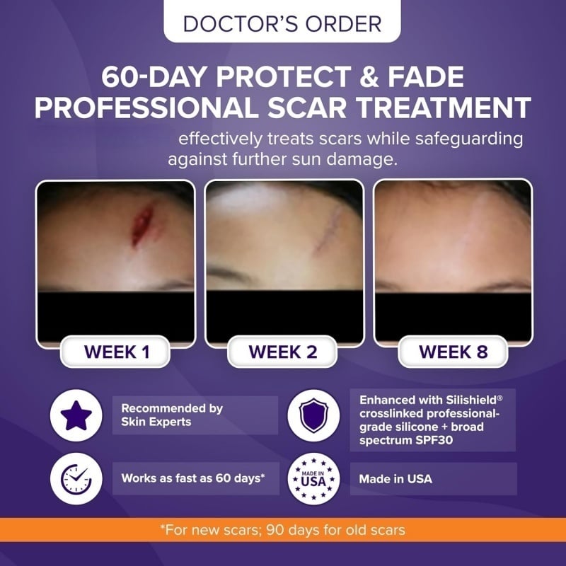 Skin Scar Solutions🛡️ 60% Silicone Scar Stick