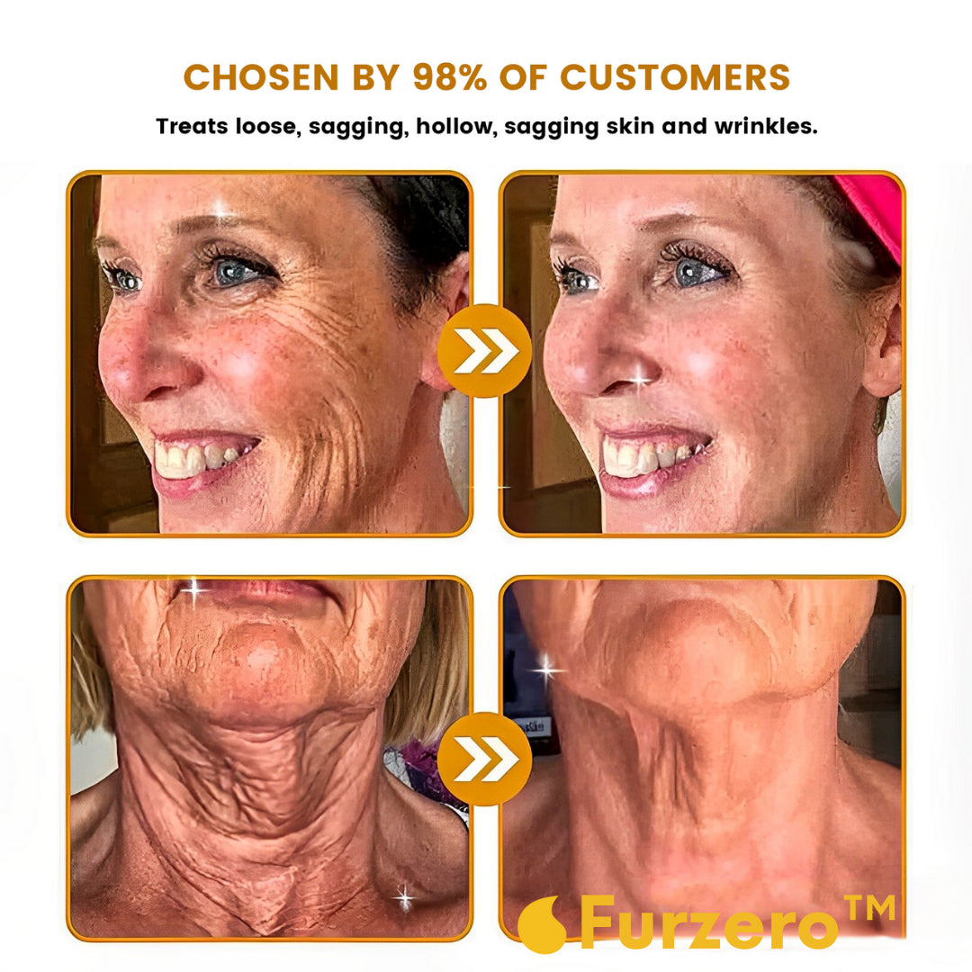 NEGUSY™ |Restore Youthful Skinin Just 7 Days!