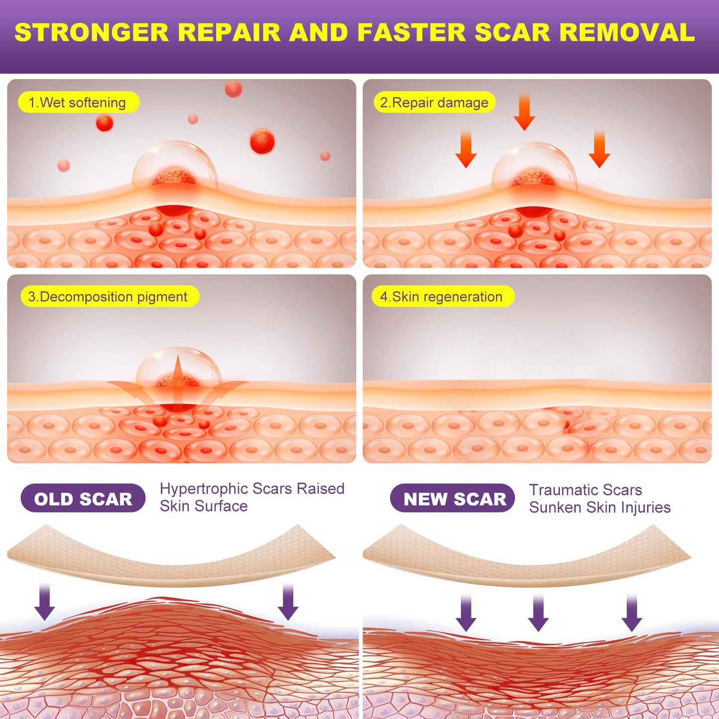 š„Fade Scars Fast ā No Pain, All Gain!š„