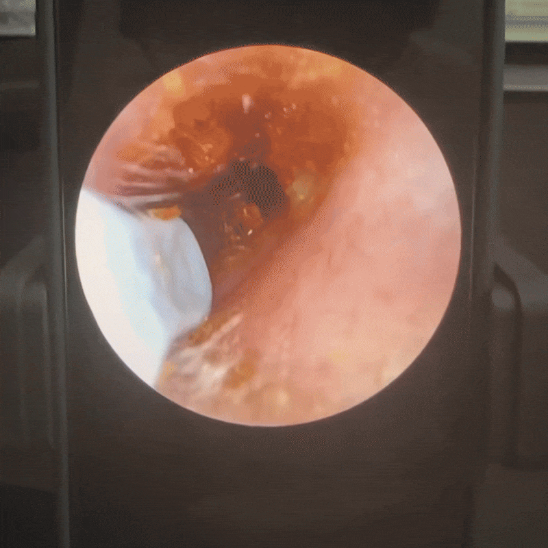 SeuricoEar