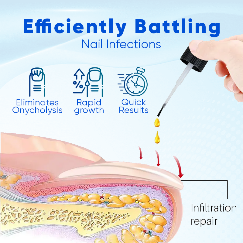 NEGUSY™ Onyxo Guard Nail Growth and Repair Serum