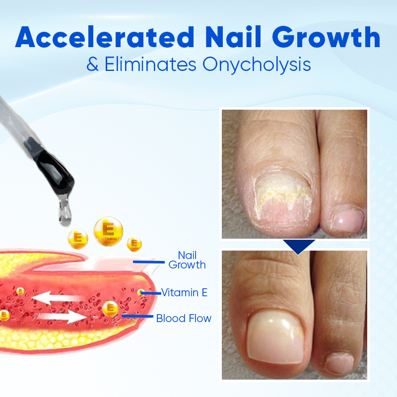 NEGUSY™ Onyxo Guard Nail Growth and Repair Serum