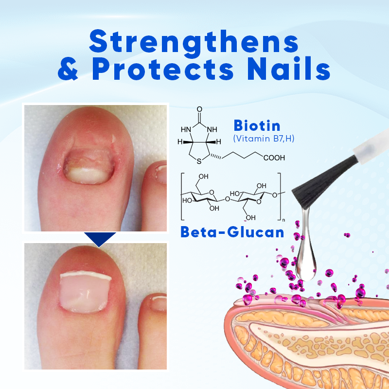 NEGUSY™ Onyxo Guard Nail Growth and Repair Serum