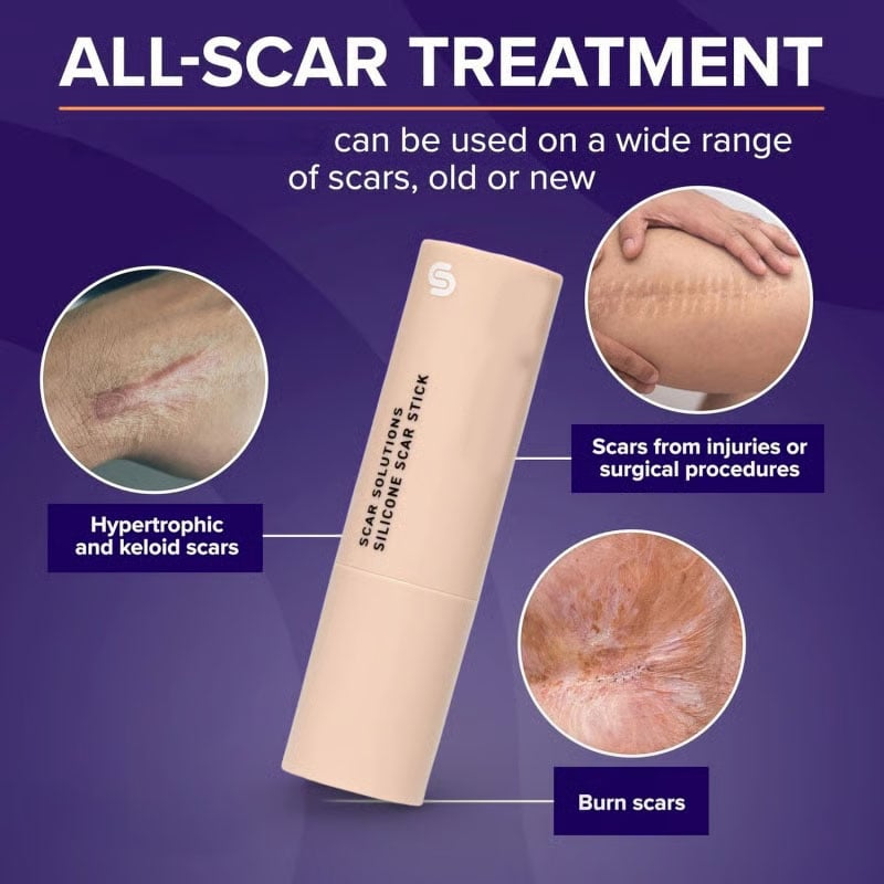 Skin Scar Solutions🛡️ 60% Silicone Scar Stick