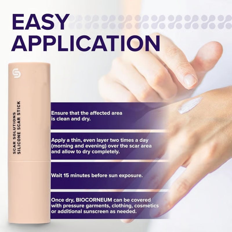 Skin Scar Solutions🛡️ 60% Silicone Scar Stick