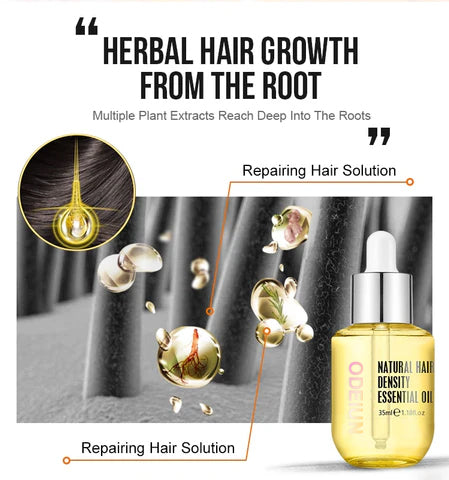 【Official Flagship Store 】ODEIUN™ Grows Hair Oil