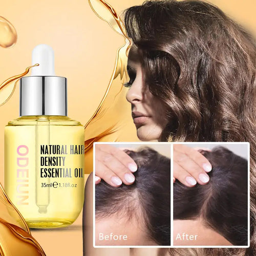 【Official Flagship Store 】ODEIUN™ Grows Hair Oil