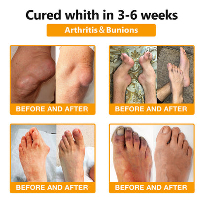 JEREMYTIS™ Bee-Venom Pain-Relief Bone Healing Cream🐝(Specially forolder adults & AAOS recommends)🔥