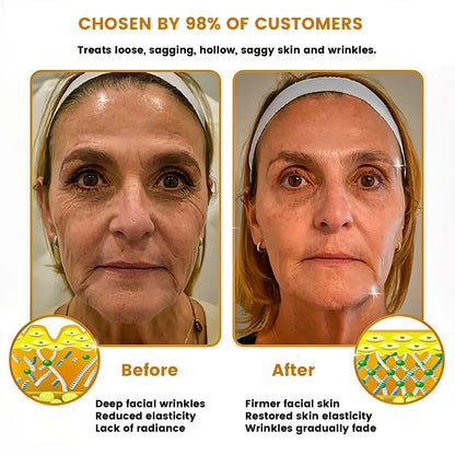 NEGUSY™ |Restore Youthful Skinin Just 7 Days!