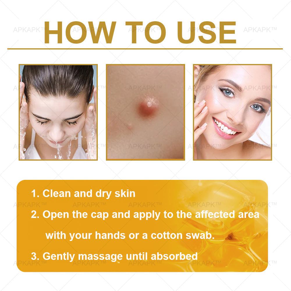 JEREMYTIS™ Bee Venom Multi-Purpose Skin Treatment Cream