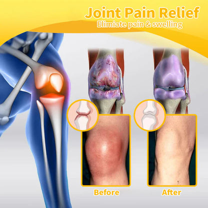 JEREMYTIS™ Bee-Venom Pain-Relief Bone Healing Cream🐝(Specially forolder adults & AAOS recommends)🔥