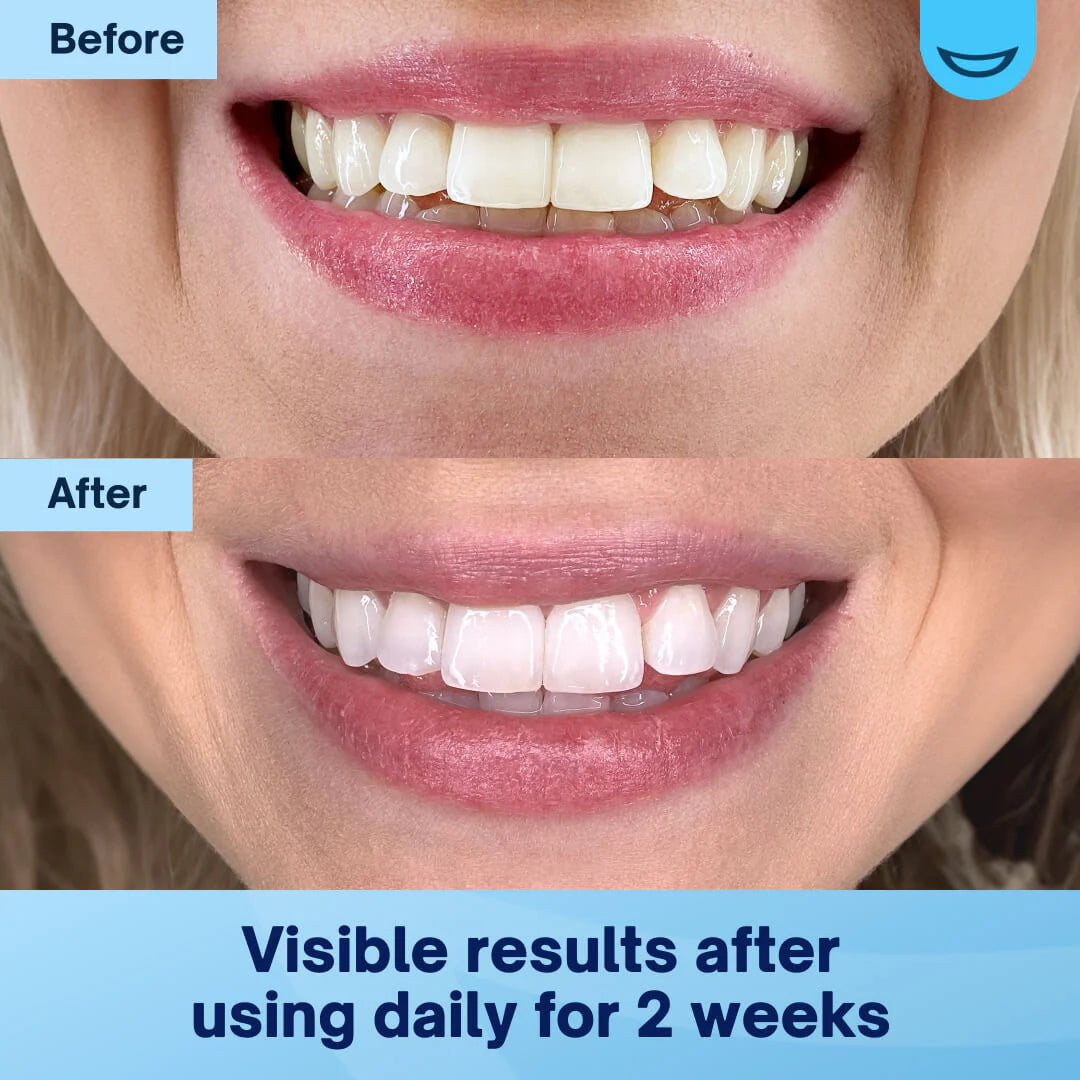 JEREMYTIS™ Teeth Whitening Powder