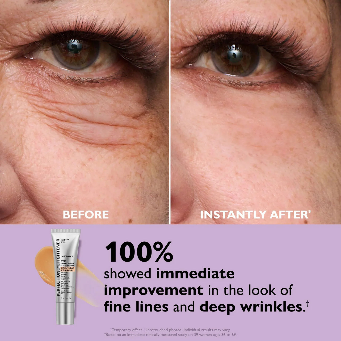 Instant Eye Lift in Seconds! ✨👀
